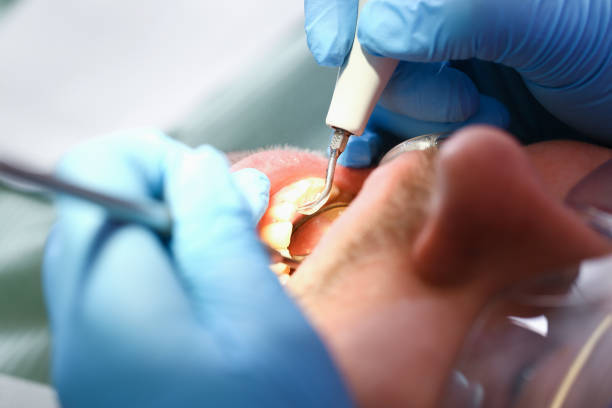 Best Pediatric Emergency Dentist in Moundville, AL