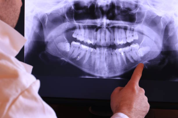 Best Emergency Broken Tooth Repair in Moundville, AL