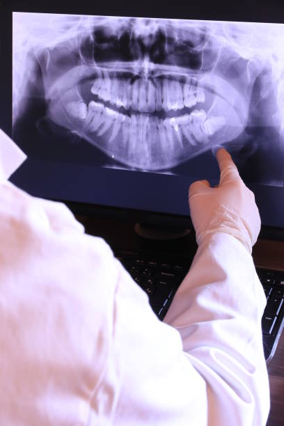 Best Emergency Root Canal Treatment in Moundville, AL