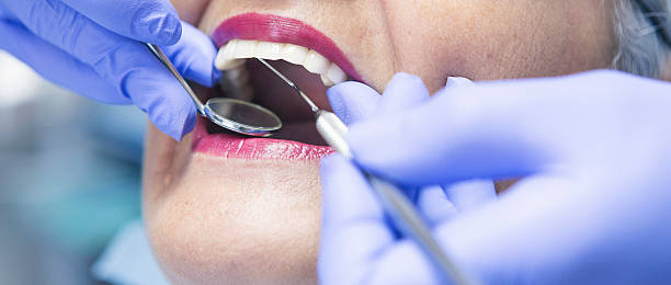 Best Emergency Tooth Extraction in Moundville, AL