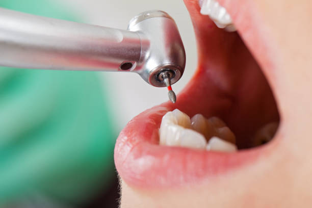 Best Same-Day Emergency Dentist in Moundville, AL